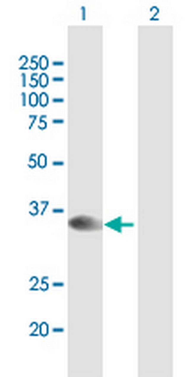 STX16 Antibody in Western Blot (WB)