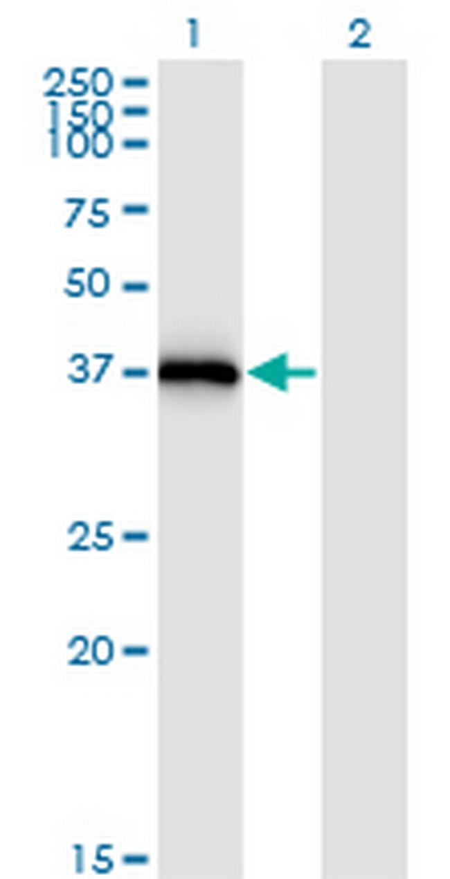 STX16 Antibody in Western Blot (WB)
