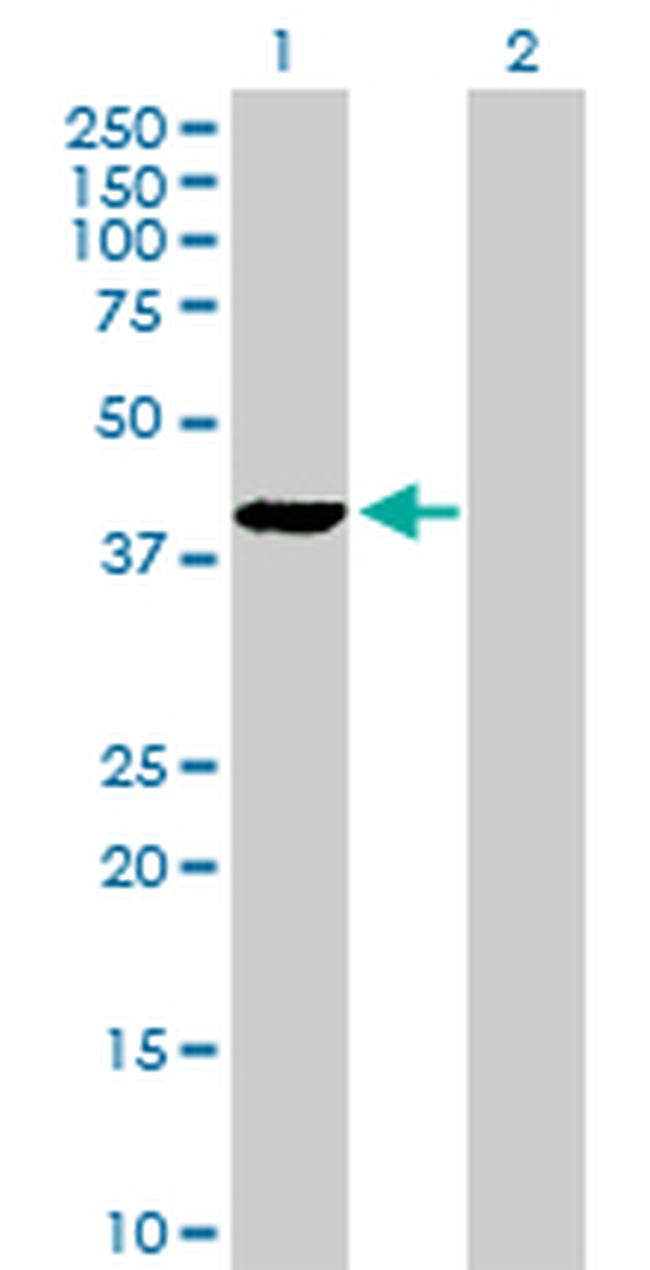 PLA2G4B Antibody in Western Blot (WB)