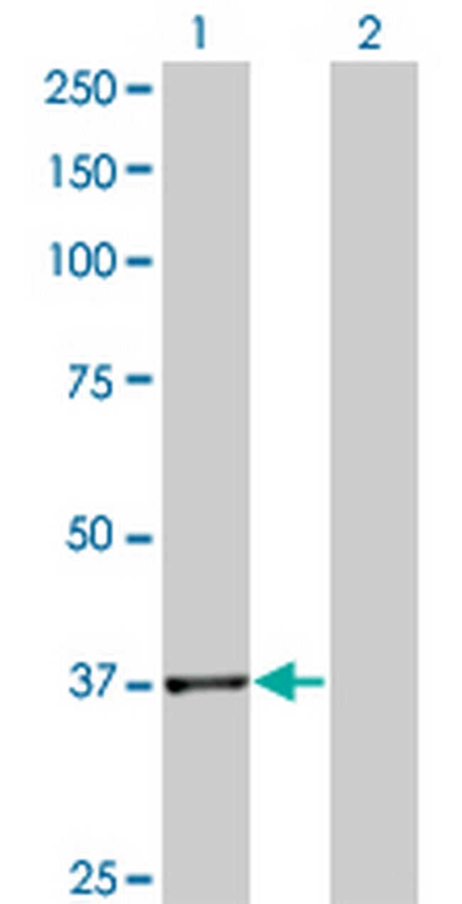 PLA2G4B Antibody in Western Blot (WB)