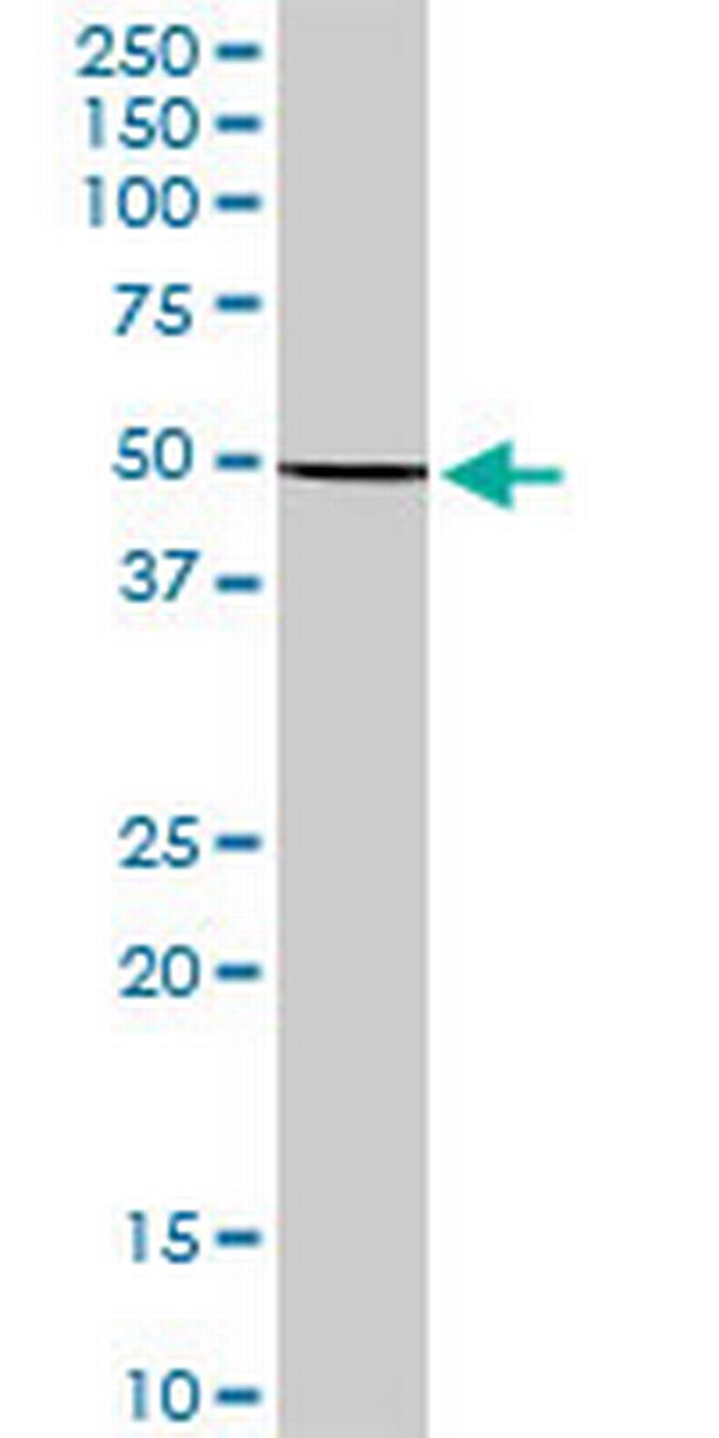 KRT36 Antibody in Western Blot (WB)