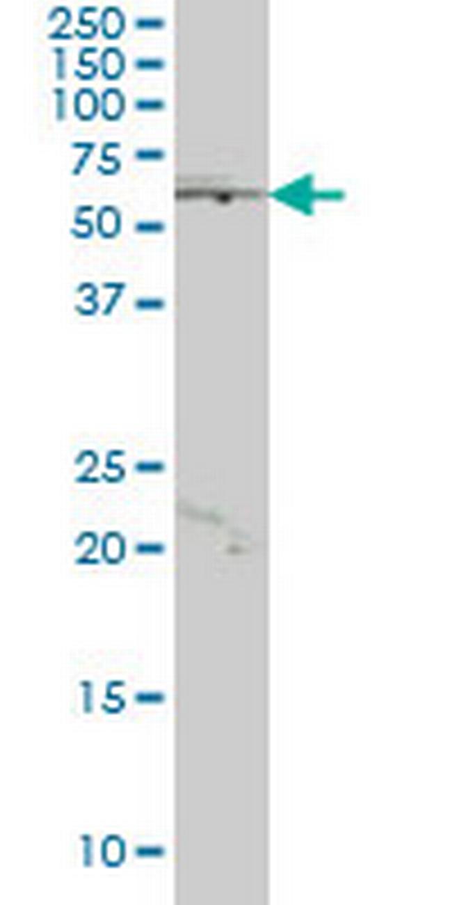 JRKL Antibody in Western Blot (WB)