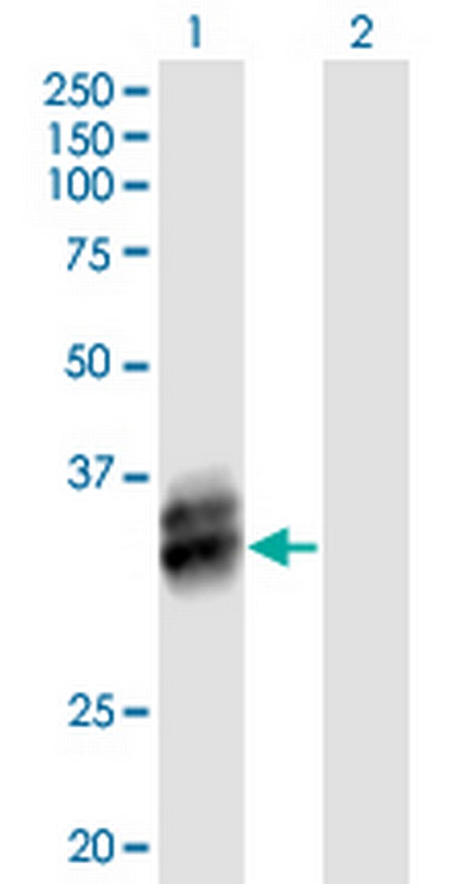 B4GALT4 Antibody in Western Blot (WB)