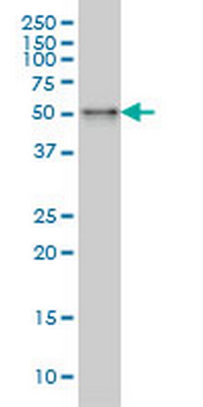 SNX4 Antibody in Western Blot (WB)