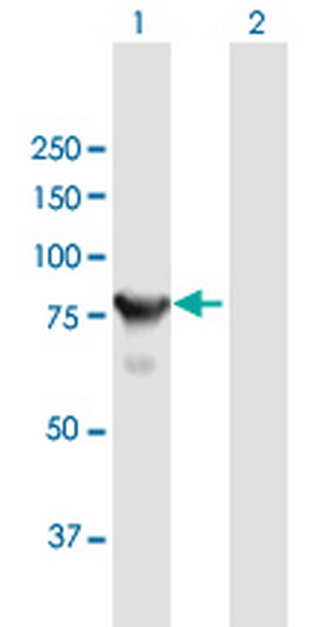 CTNNAL1 Antibody in Western Blot (WB)