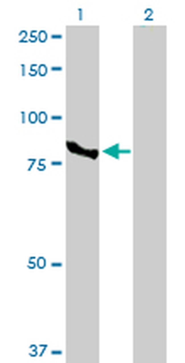 CTNNAL1 Antibody in Western Blot (WB)