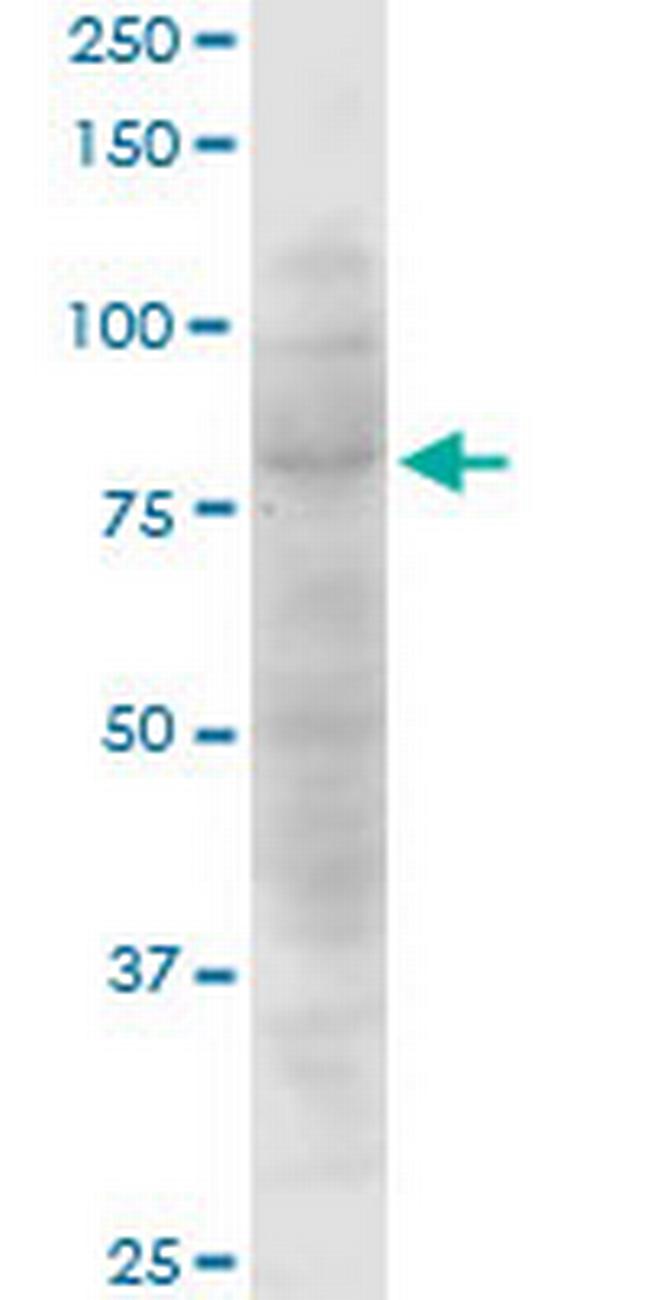 CTNNAL1 Antibody in Western Blot (WB)