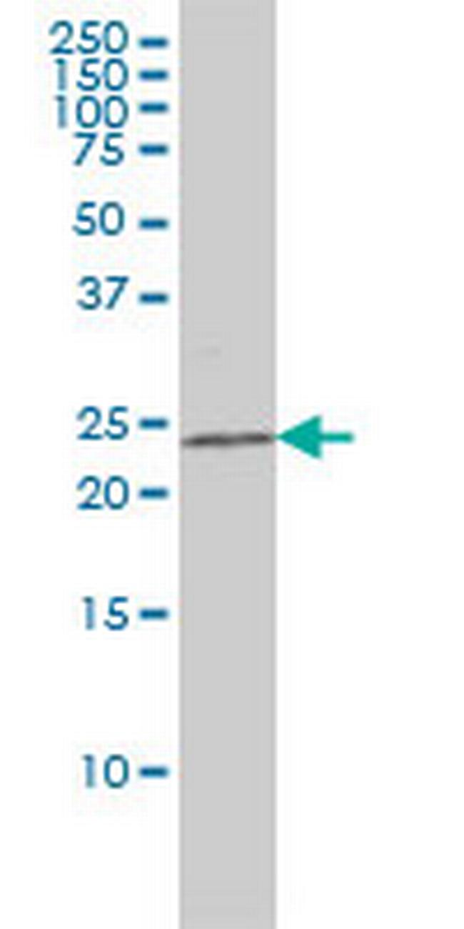 CRADD Antibody in Western Blot (WB)