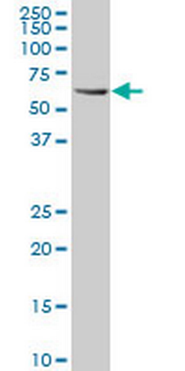 RIPK2 Antibody in Western Blot (WB)