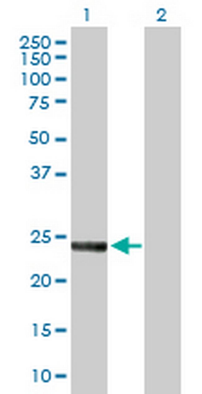 SNAP23 Antibody in Western Blot (WB)