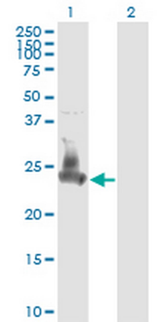 SNAP23 Antibody in Western Blot (WB)