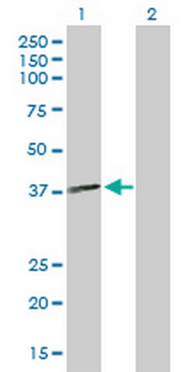 MTMR1 Antibody in Western Blot (WB)