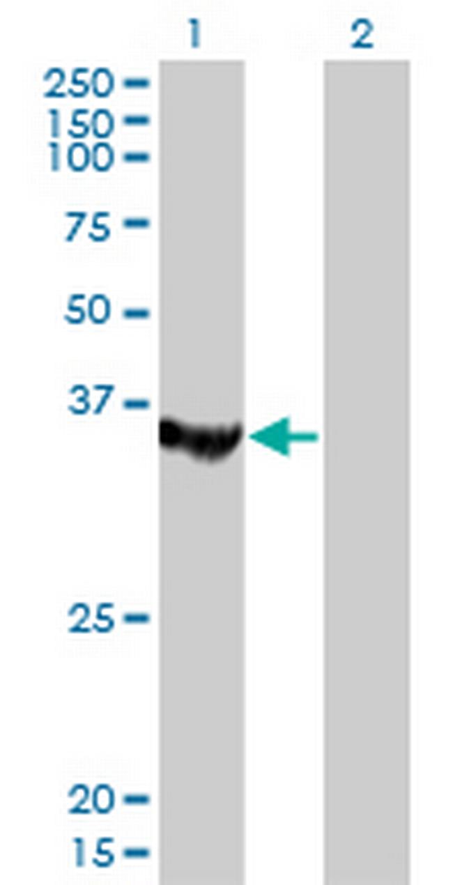 MTMR1 Antibody in Western Blot (WB)