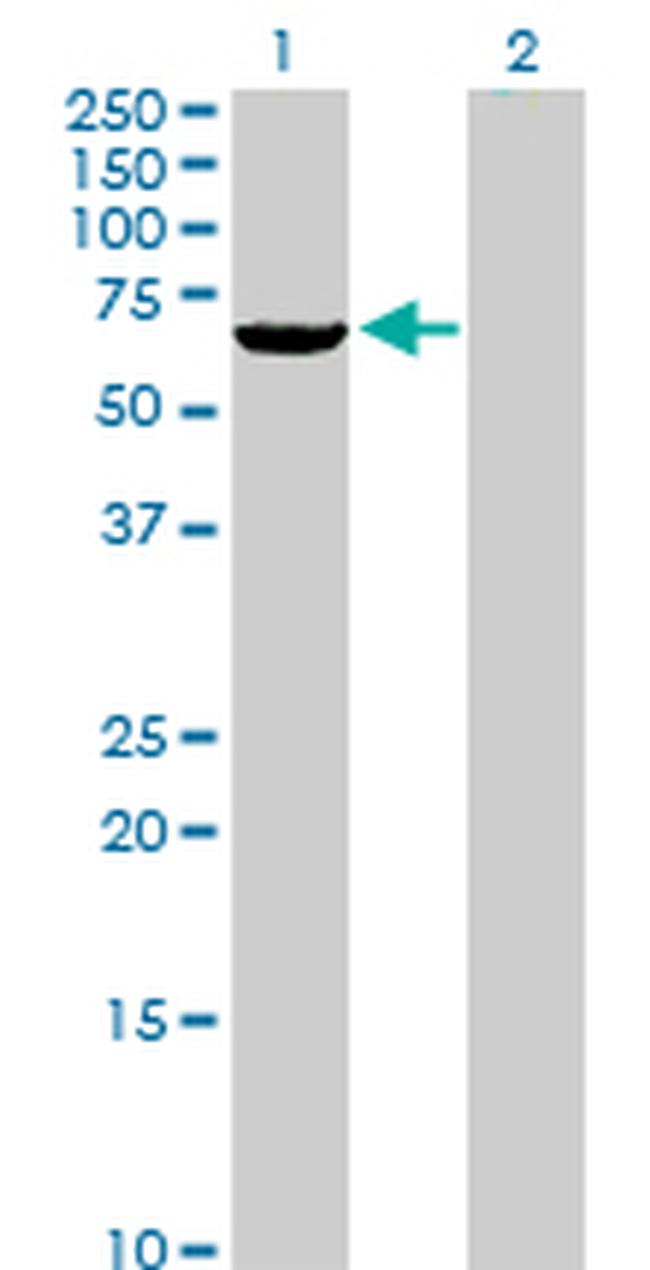 RIOK3 Antibody in Western Blot (WB)
