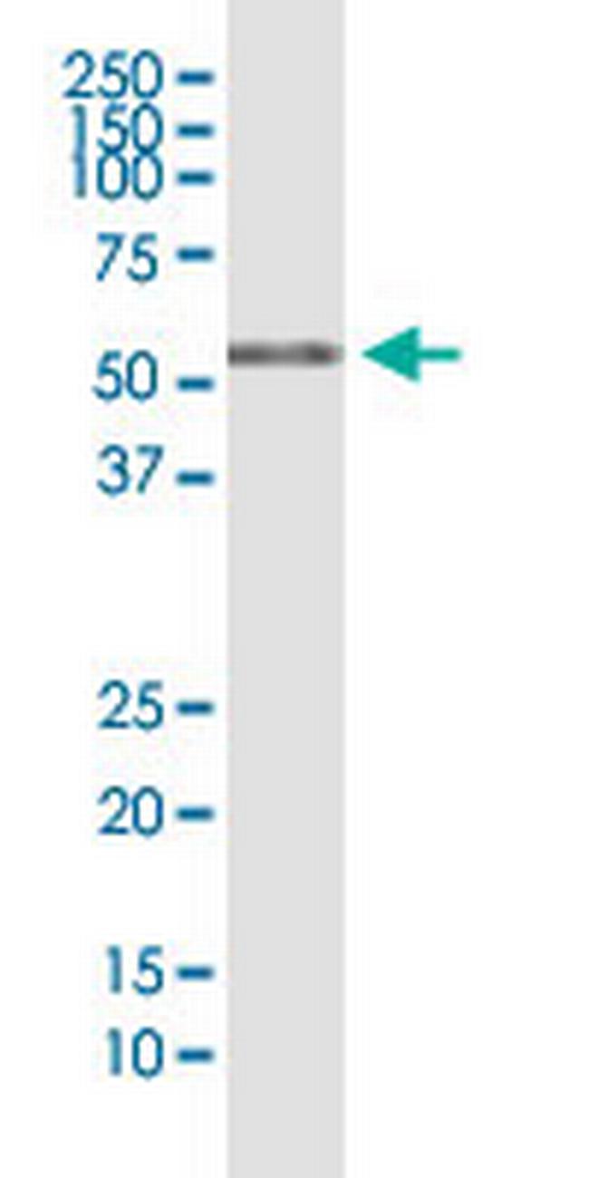 RIOK3 Antibody in Western Blot (WB)