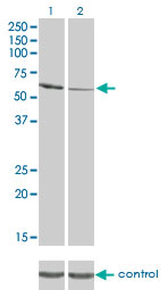 RIOK3 Antibody in Western Blot (WB)