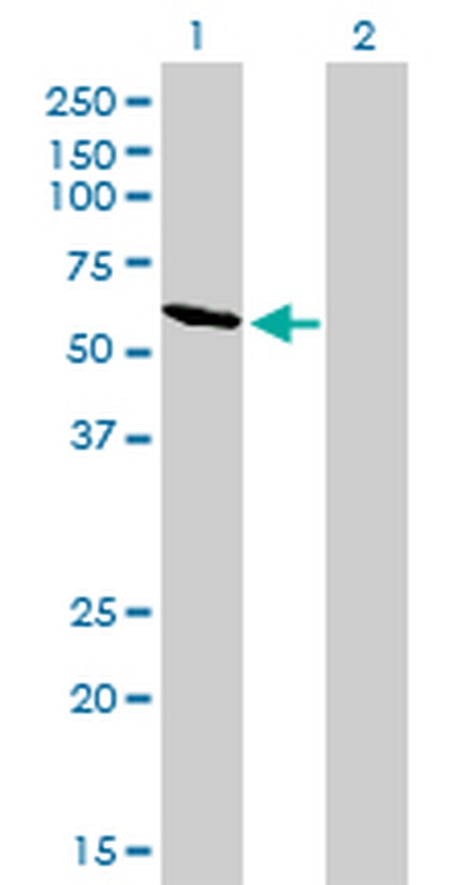 RIOK3 Antibody in Western Blot (WB)