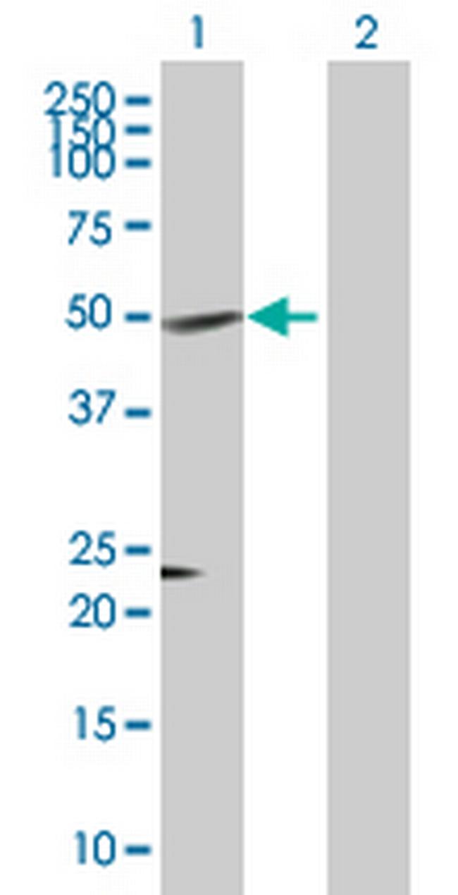 RGS11 Antibody in Western Blot (WB)