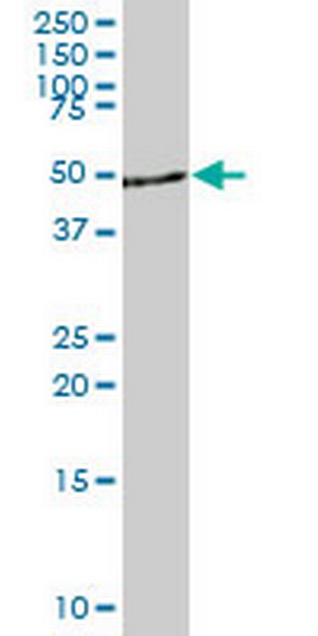 DYRK4 Antibody in Western Blot (WB)