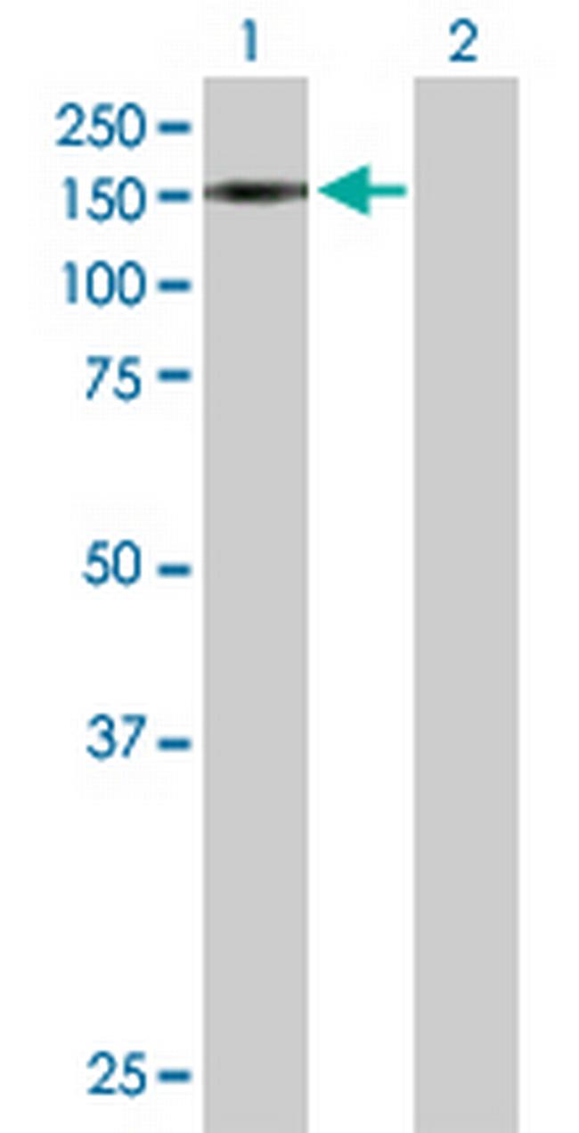 TRIM24 Antibody in Western Blot (WB)