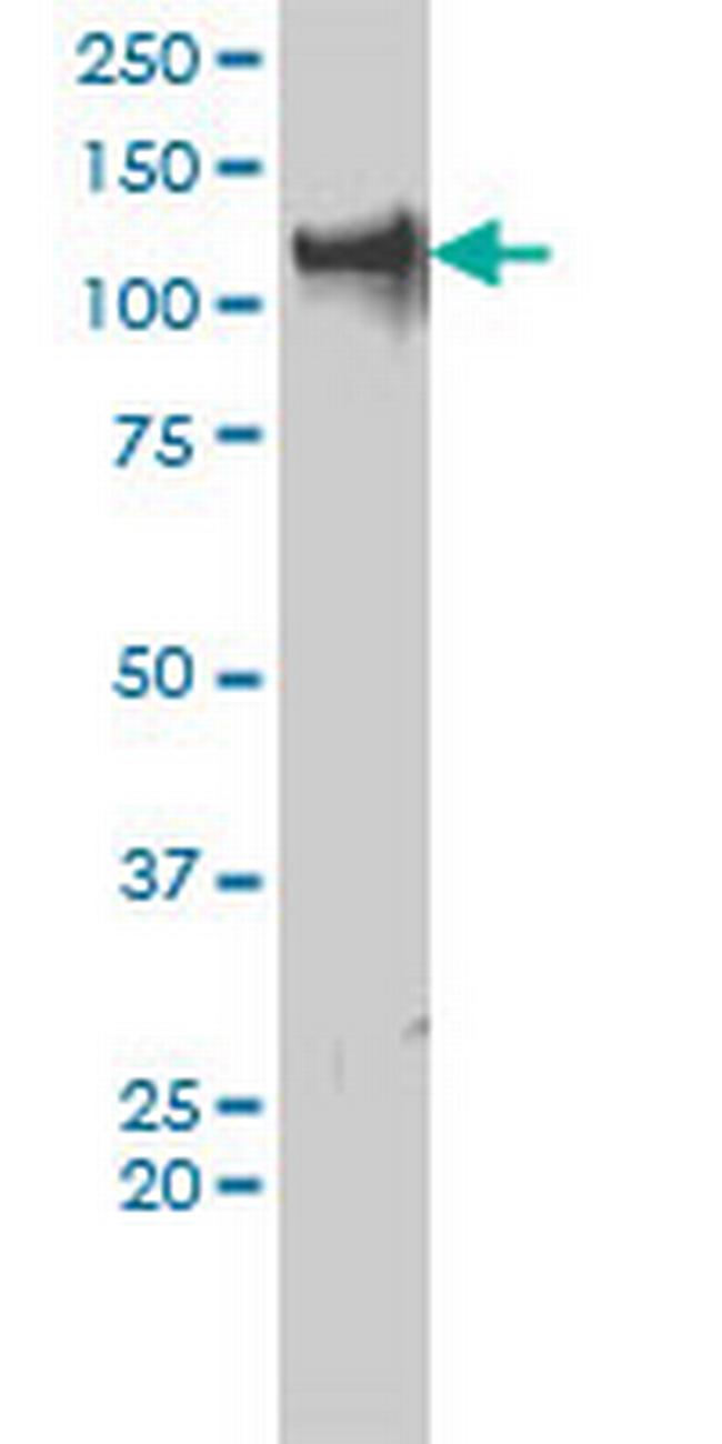 TRIM24 Antibody in Western Blot (WB)
