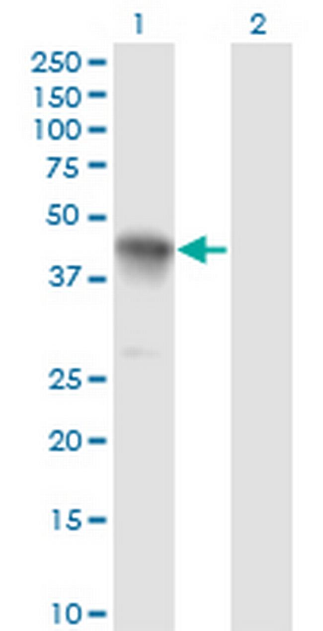 CCNK Antibody in Western Blot (WB)