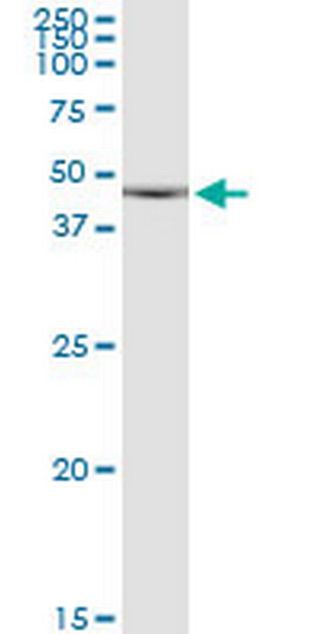 CDKL1 Antibody in Western Blot (WB)