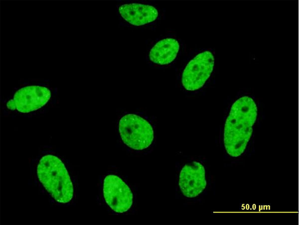 CDKL1 Antibody in Immunocytochemistry (ICC/IF)