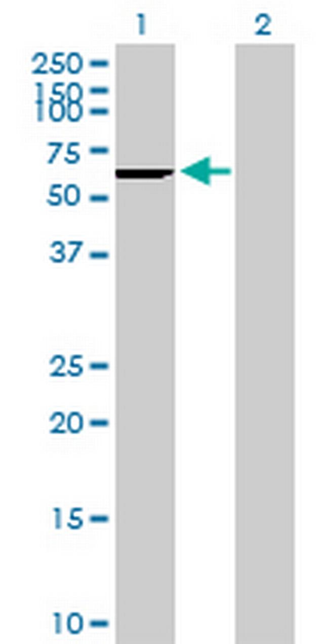 CES2 Antibody in Western Blot (WB)