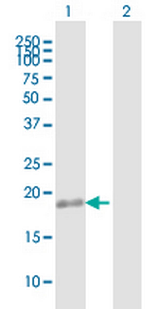 TMEM11 Antibody in Western Blot (WB)