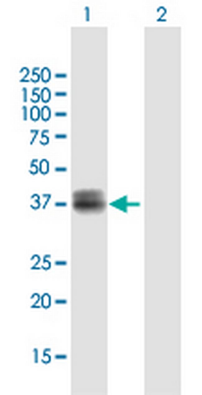WISP3 Antibody in Western Blot (WB)