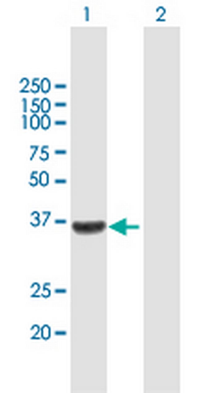 WISP1 Antibody in Western Blot (WB)