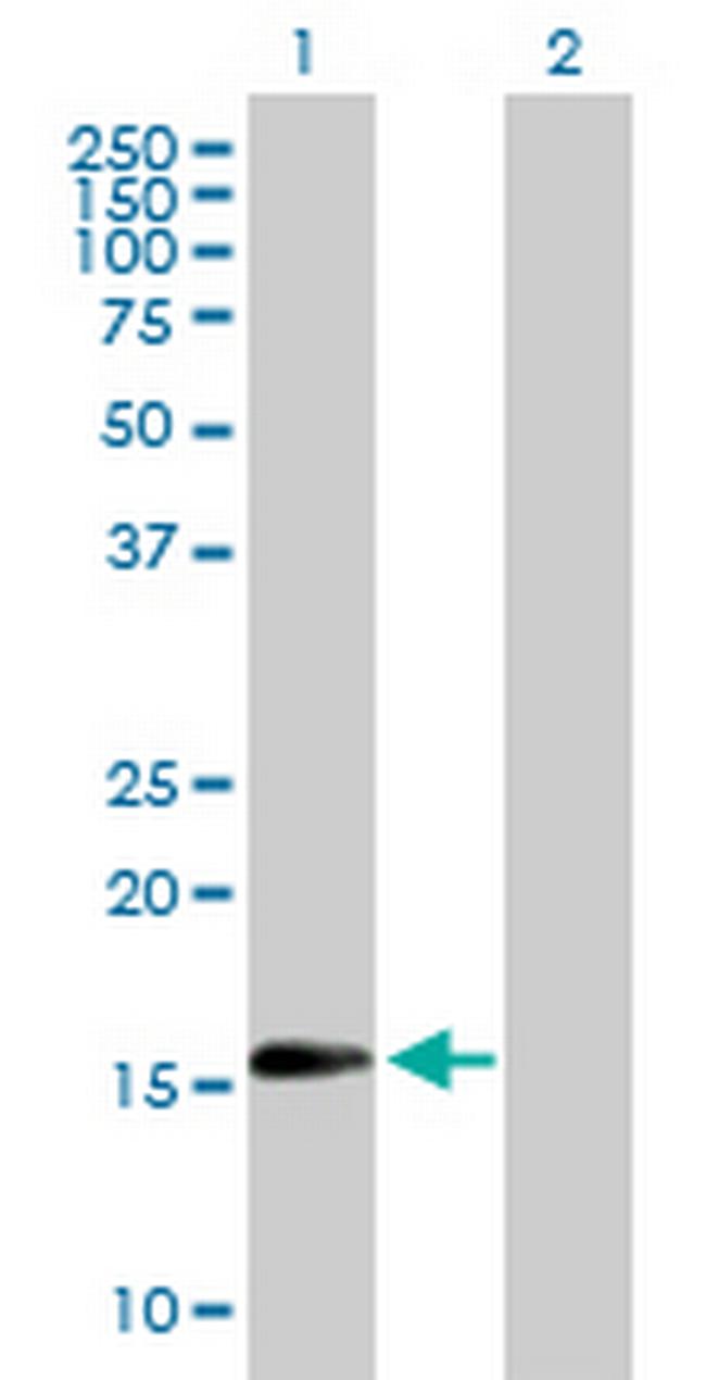 TSC22D1 Antibody in Western Blot (WB)