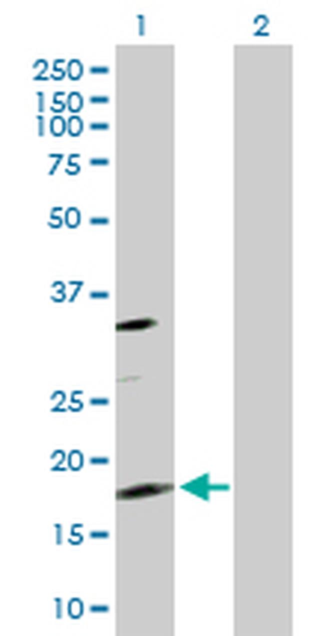 TSC22D1 Antibody in Western Blot (WB)