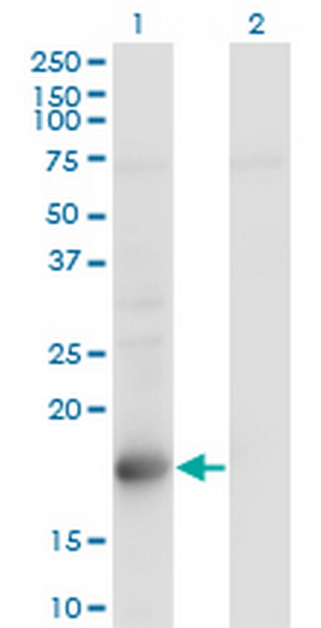 TSC22D1 Antibody in Western Blot (WB)