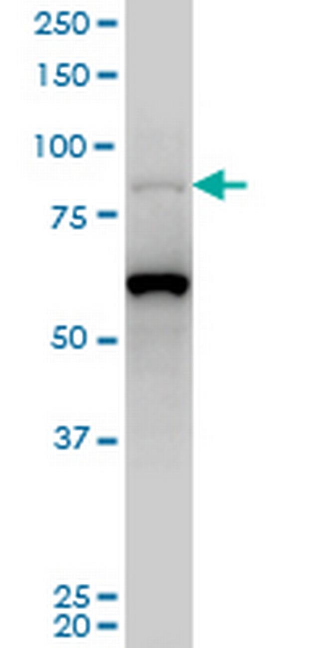 PCAF Antibody in Western Blot (WB)