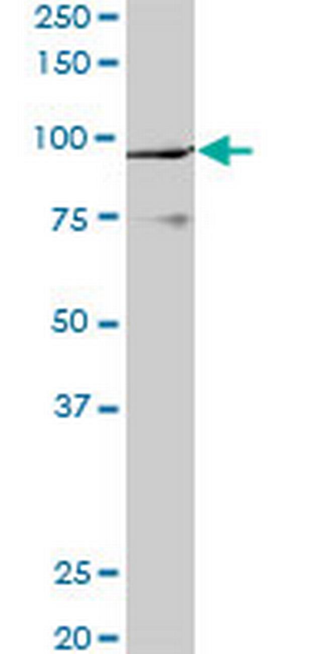 PCAF Antibody in Western Blot (WB)