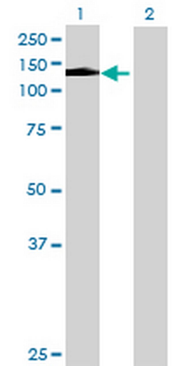 DDEF2 Antibody in Western Blot (WB)