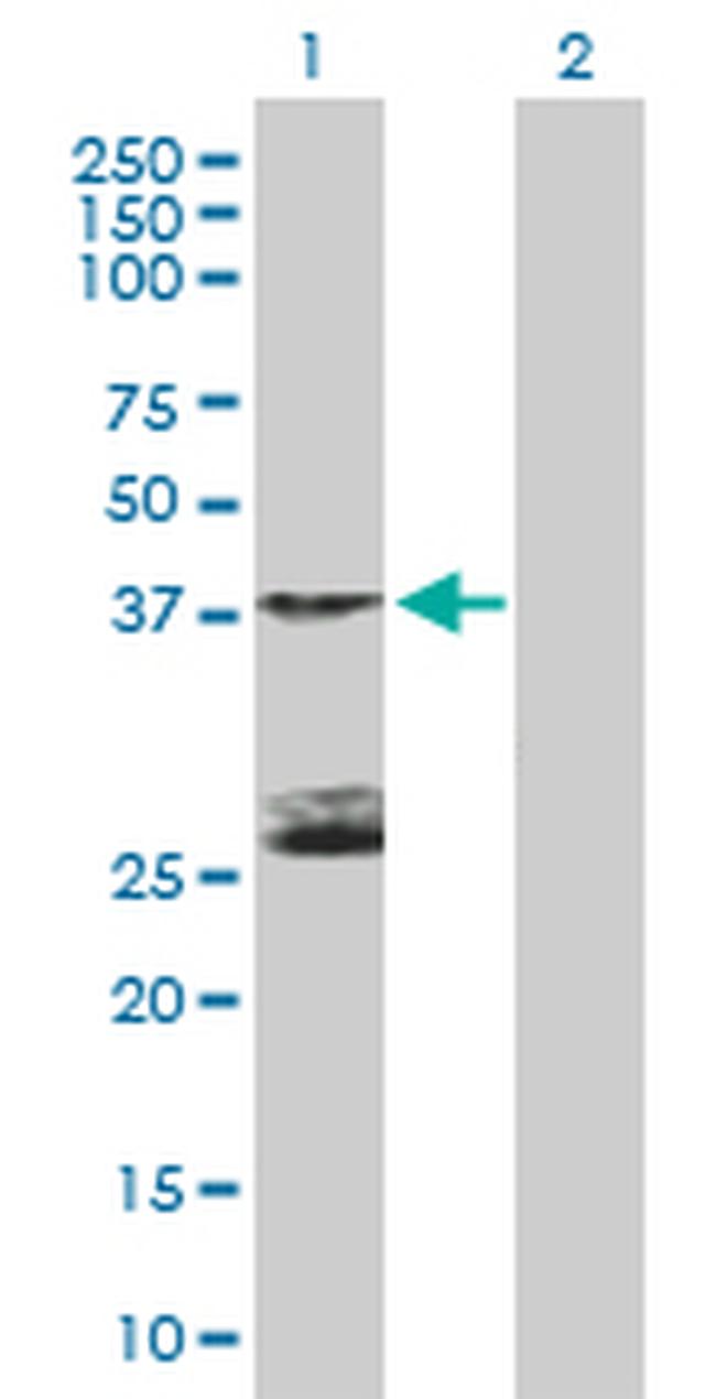 STK19 Antibody in Western Blot (WB)