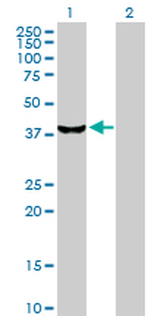 STK19 Antibody in Western Blot (WB)