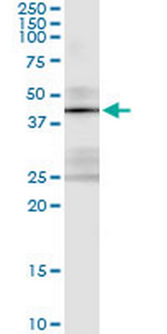 STK19 Antibody in Immunoprecipitation (IP)