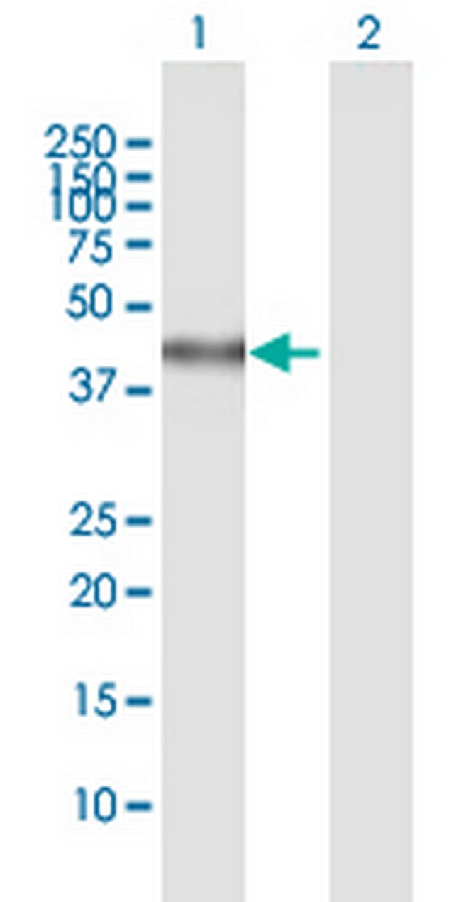 SPHK1 Antibody in Western Blot (WB)