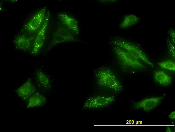 SQSTM1 Antibody in Immunocytochemistry (ICC/IF)