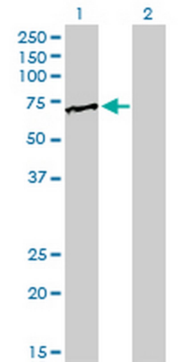 FUBP1 Antibody in Western Blot (WB)