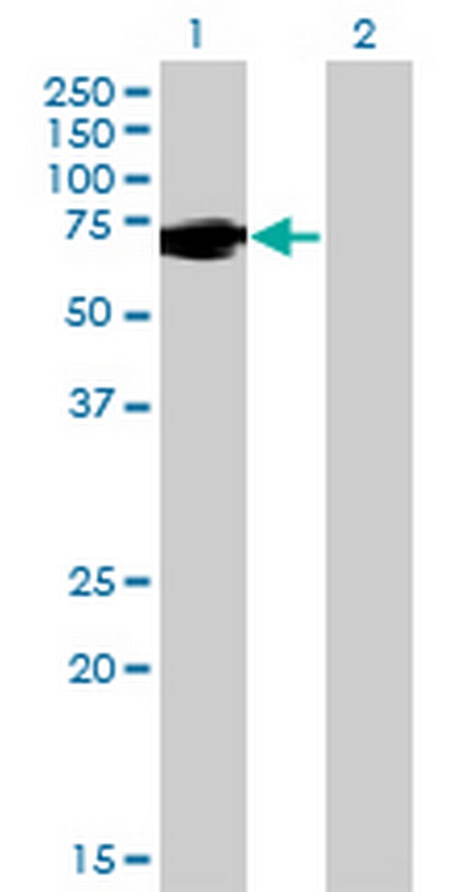 FUBP1 Antibody in Western Blot (WB)