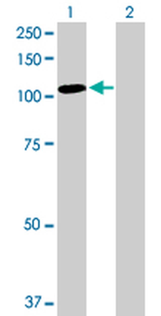 TAX1BP1 Antibody in Western Blot (WB)