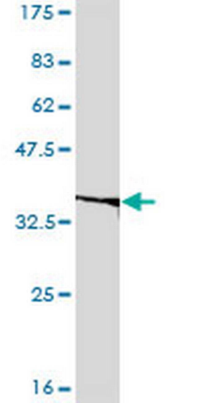 EIF2B2 Antibody in Western Blot (WB)
