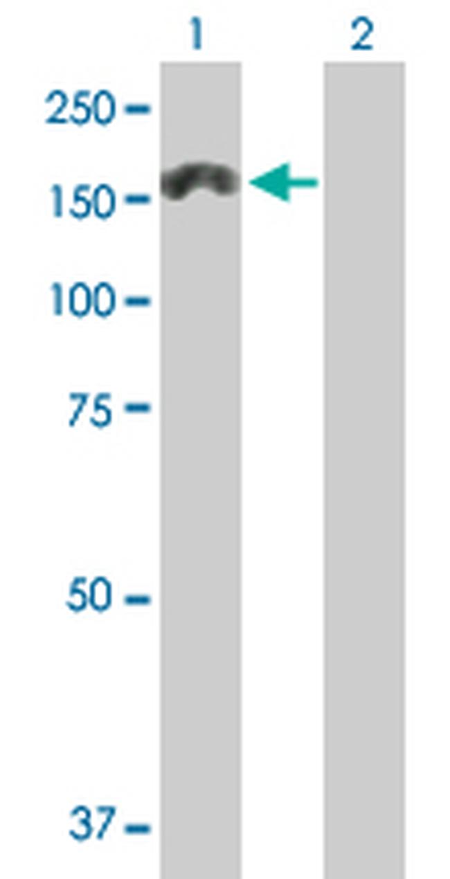 MTMR3 Antibody in Western Blot (WB)