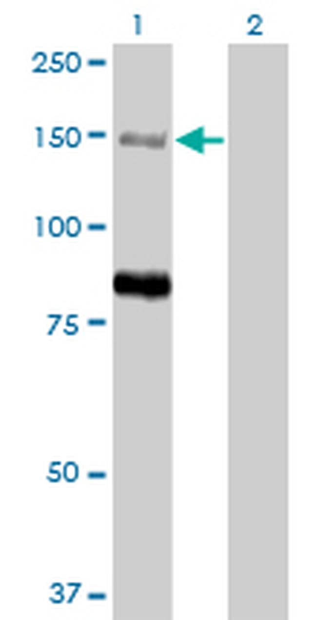 MTMR3 Antibody in Western Blot (WB)