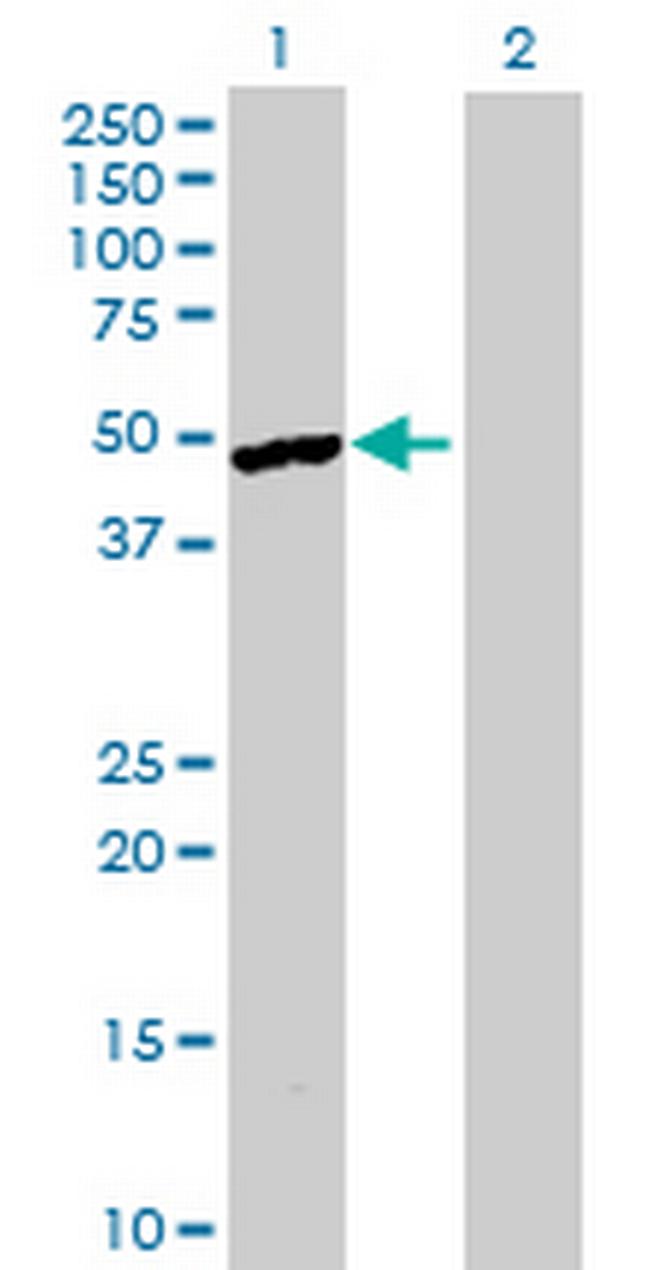 SGCE Antibody in Western Blot (WB)